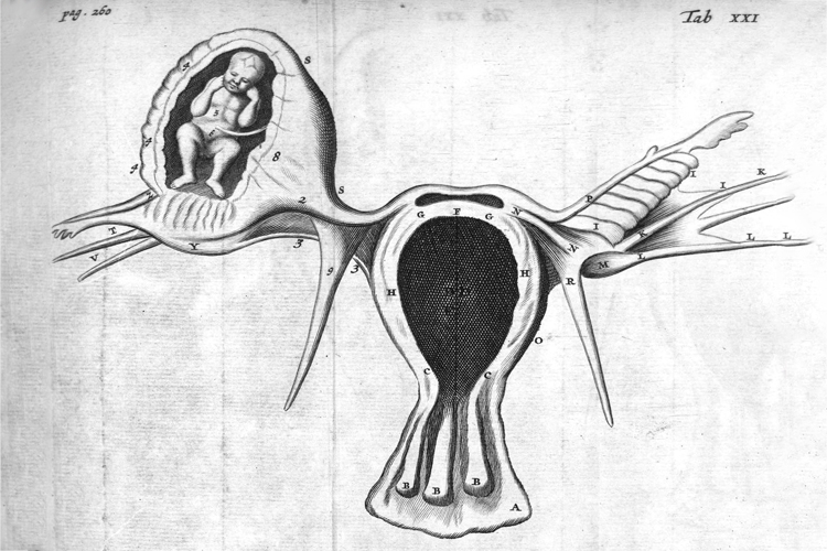 An anatomical illustration of an ectopic pregnancy